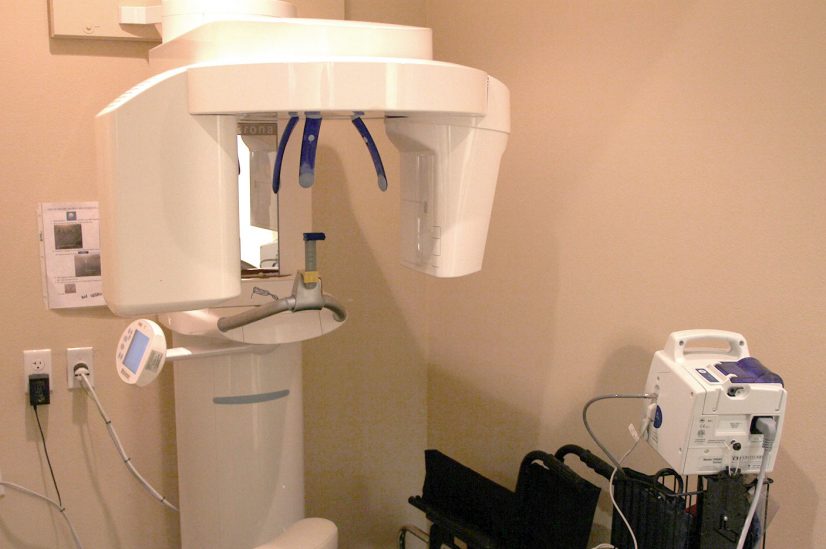 cone beam x ray equipment