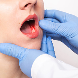 doctor checks for periodontal disease